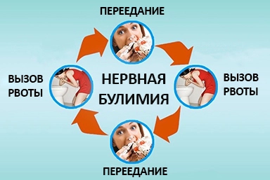 Лечение булимии в Краснощеково